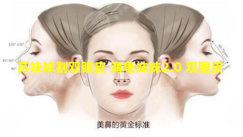 苏妹妹割双眼皮 海龟妹妹2.0 双眼皮